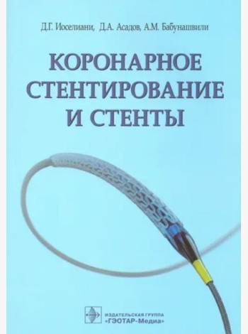 Коронарное стентирование и стенты