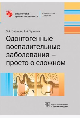 Одонтогенные воспалительные заболевания - просто о сложном