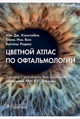 Цветной атлас по офтальмологии