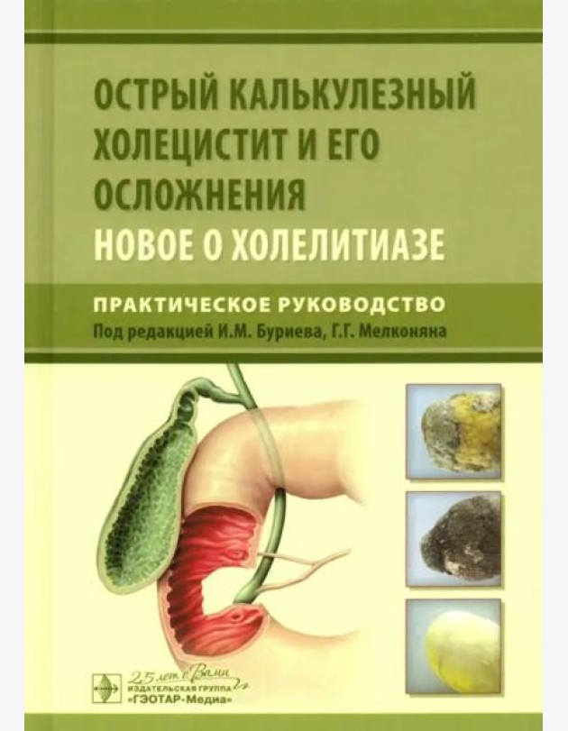 Острый калькулезный холецистит и его осложнения. Новое о холелитиазе. Практическое руководство