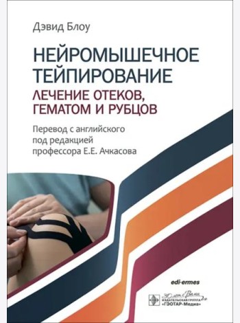 Нейромышечное тейпирование. Лечение отеков, гематом и рубцов