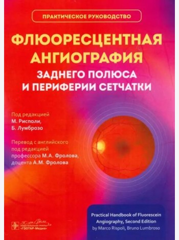 Флюоресцентная ангиография заднего полюса и периферии сетчатки