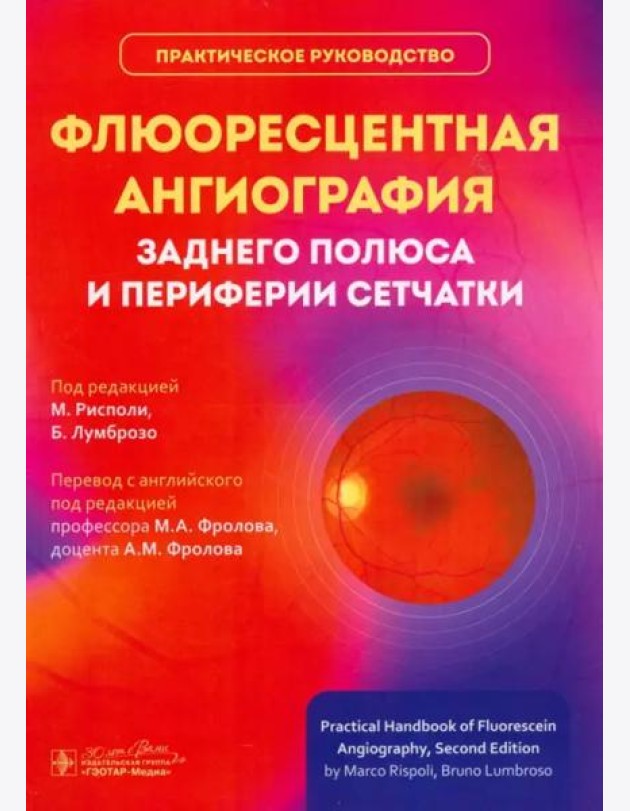 Флюоресцентная ангиография заднего полюса и периферии сетчатки