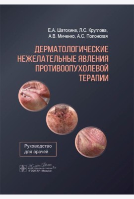 Дерматологические нежелательные явления противоопухолевой терапии: руководство для врачей