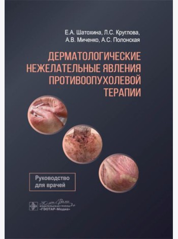 Дерматологические нежелательные явления противоопухолевой терапии: руководство для врачей