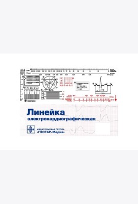 Линейка электрокардиографическая: ЭКГ-линейка для расшифровки электрокардиограммы, снятой со скоростью 50 или 25 мм/с