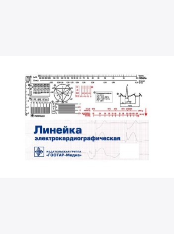 Линейка электрокардиографическая: ЭКГ-линейка для расшифровки электрокардиограммы, снятой со скоростью 50 или 25 мм/с