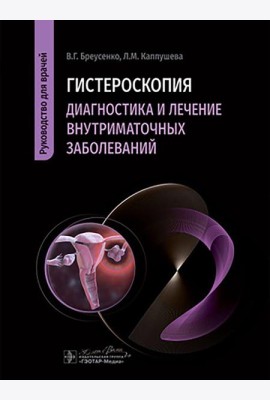 Гистероскопия. Диагностика и лечение внутриматочных заболеваний: руководство для врачей