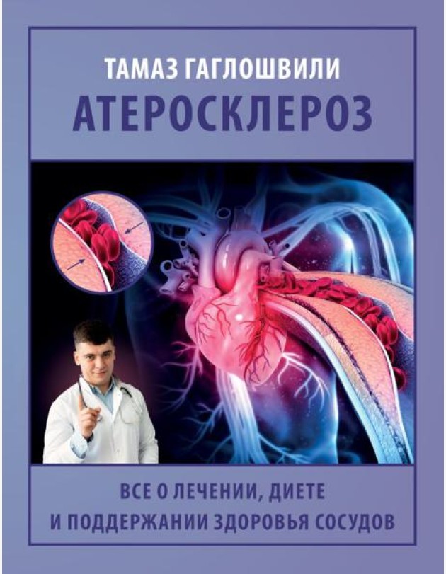 Атеросклероз. Все о лечении, диете и поддержании здоровья сосудов