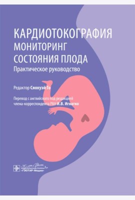 Кардиотокография. Мониторинг состояния плода. Практическое руководство