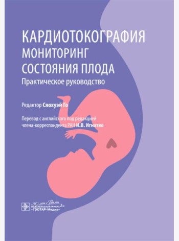 Кардиотокография. Мониторинг состояния плода. Практическое руководство