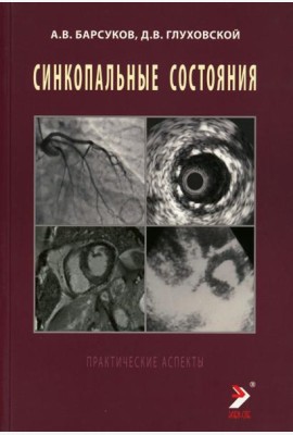 Синкопальные состояния: практические аспекты