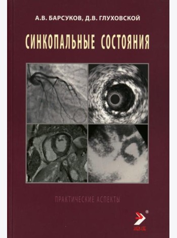 Синкопальные состояния: практические аспекты
