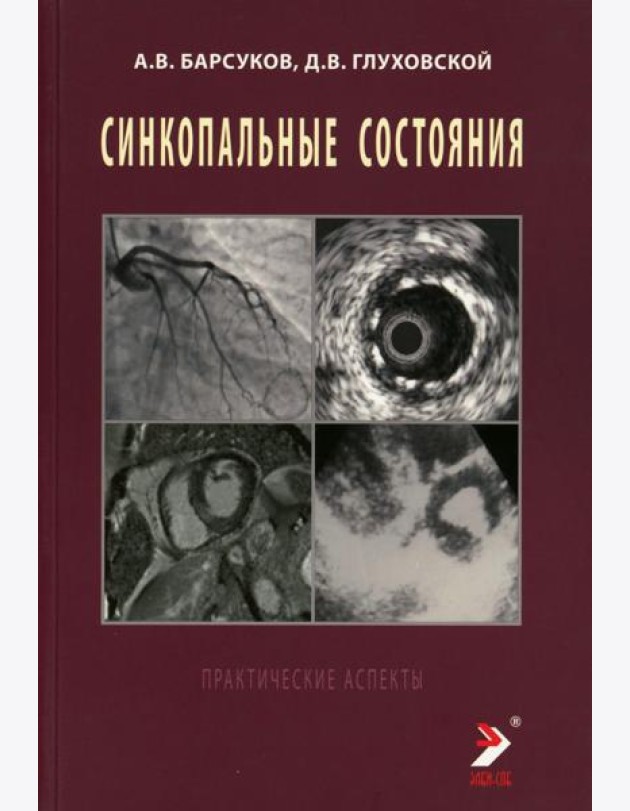 Синкопальные состояния: практические аспекты