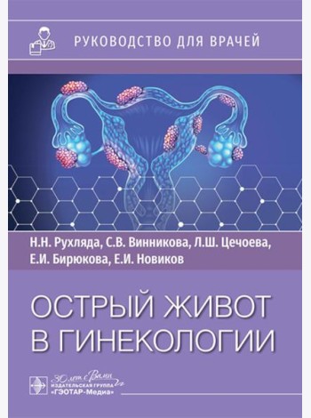 Острый живот в гинекологии: руководство для врачей