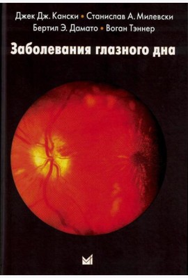 Заболевания глазного дна. 4-е изд