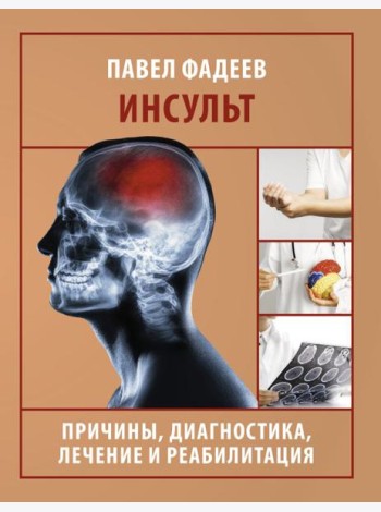 Инсульт. Причины, диагностика, лечение и реабилитация