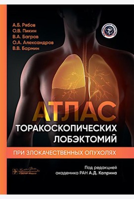 Атлас торакоскопических лобэктомий при злокачественных опухолях