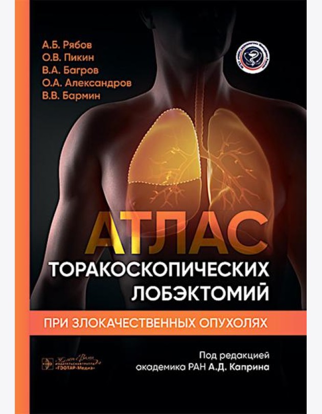 Атлас торакоскопических лобэктомий при злокачественных опухолях