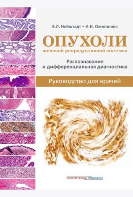 Опухоли женской репродуктивной системы. Распознавание и дифференциальная диагностика. Руководство для врачей
