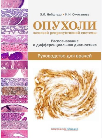 Опухоли женской репродуктивной системы. Распознавание и дифференциальная диагностика. Руководство для врачей