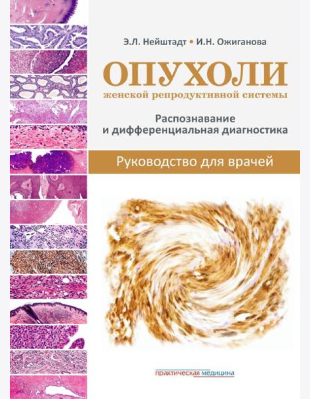 Опухоли женской репродуктивной системы. Распознавание и дифференциальная диагностика. Руководство для врачей