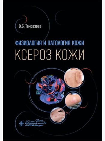 Физиология и патология кожи. Ксероз кожи