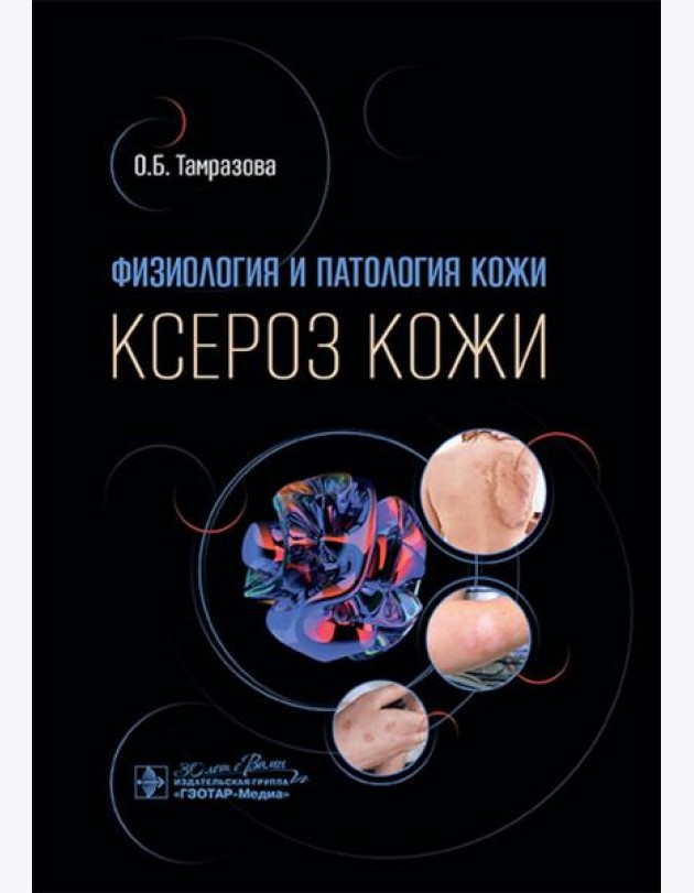 Физиология и патология кожи. Ксероз кожи