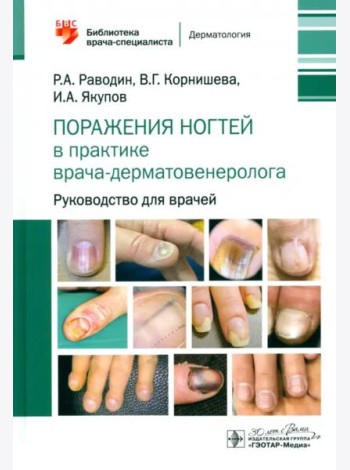 Поражения ногтей в практике врача-дерматовенеролога. Руководство для врачей