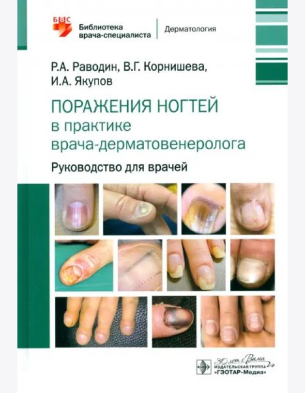 Поражения ногтей в практике врача-дерматовенеролога. Руководство для врачей