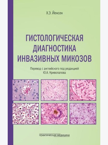 Гистологическая диагностика инвазивных микозов