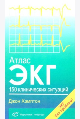Атлас ЭКГ: 150 клинических ситуаций
