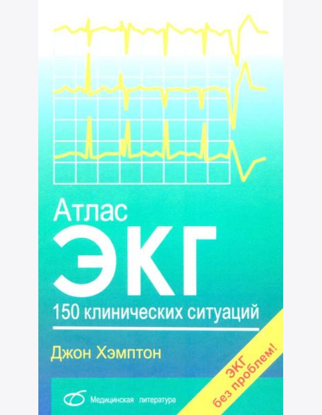 Атлас ЭКГ: 150 клинических ситуаций