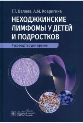 Неходжкинские лимфомы у детей и подростков
