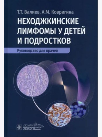 Неходжкинские лимфомы у детей и подростков