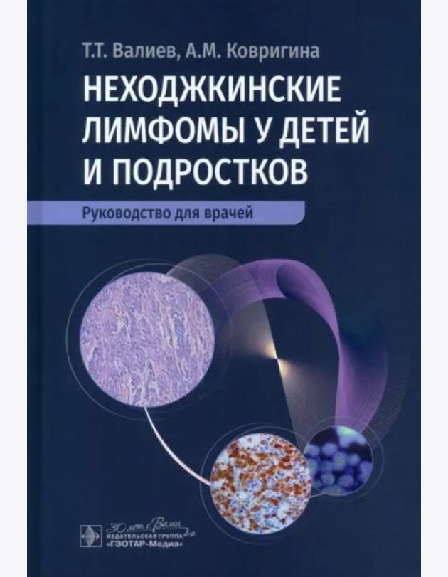Неходжкинские лимфомы у детей и подростков