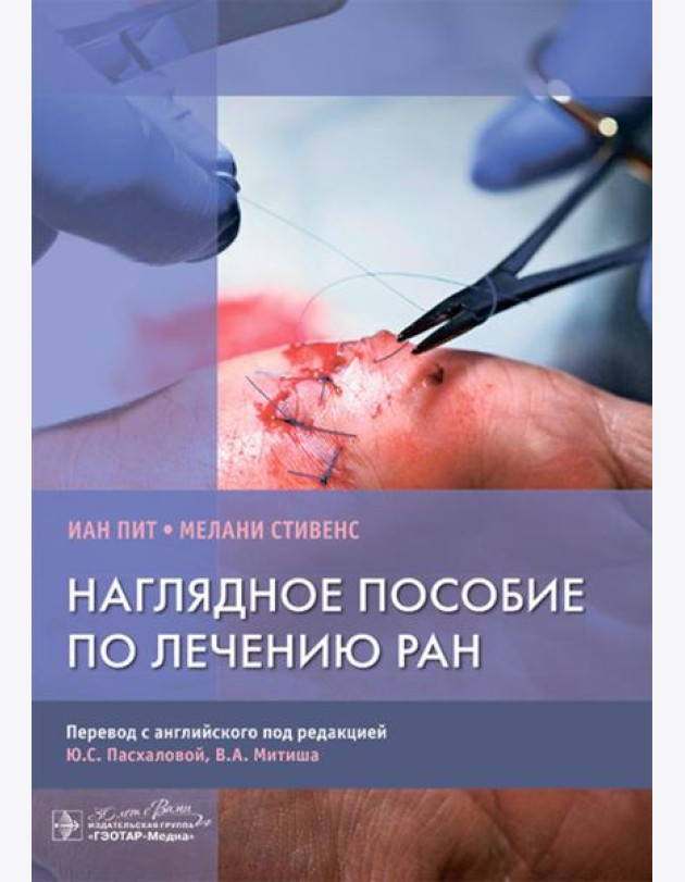 Наглядное пособие по лечению ран