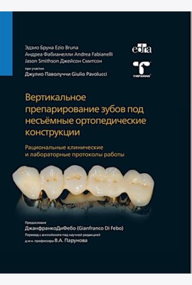Вертикальное препарирование зубов под несъемные ортопедические конструкции