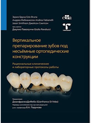 Вертикальное препарирование зубов под несъемные ортопедические конструкции