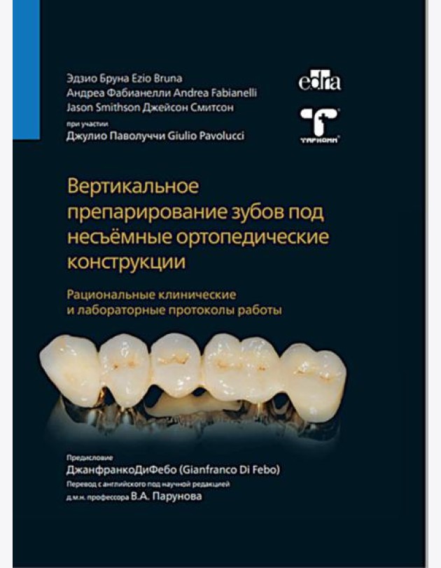 Вертикальное препарирование зубов под несъемные ортопедические конструкции