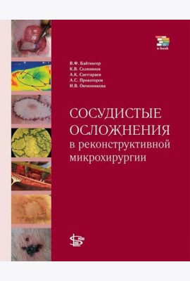 Сосудистые осложнения в реконструктивной микрохирургии