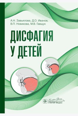 Дисфагия у детей