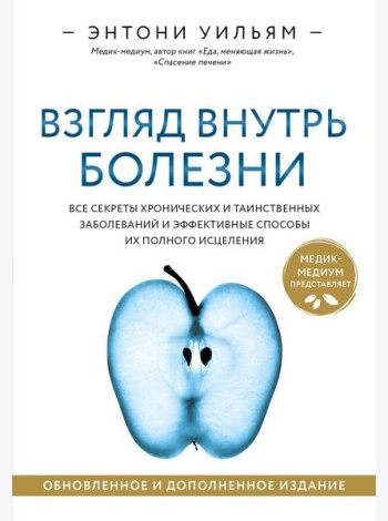 Взгляд внутрь болезни. Все секреты хронических и таинственных заболеваний и эффективные способы их полного исцеления