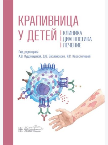 Крапивница у детей: клиника, диагностика, лечение