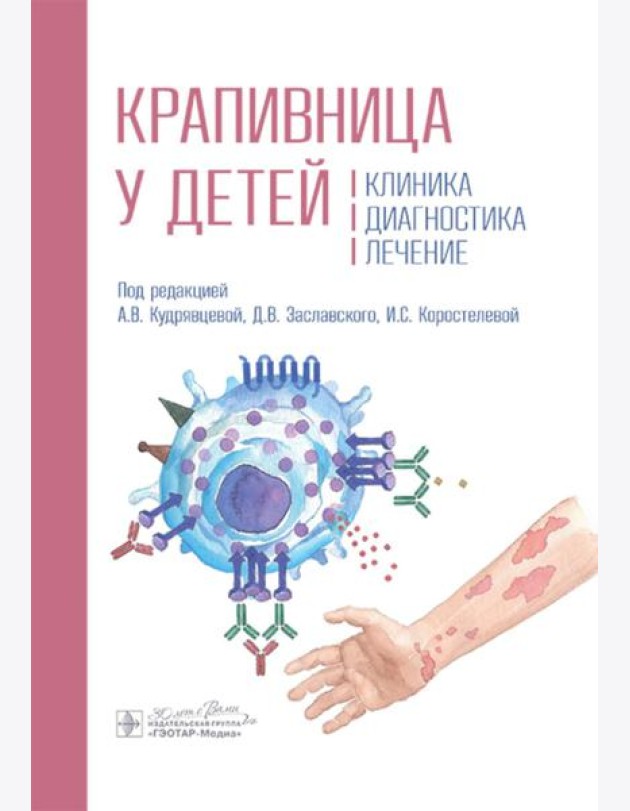 Крапивница у детей: клиника, диагностика, лечение