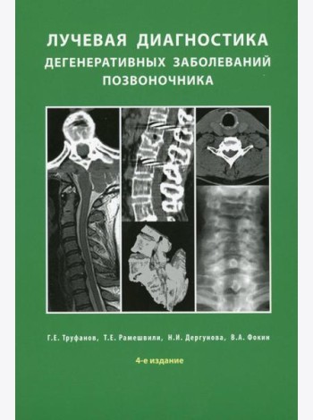 Лучевая диагностика дегенеративных заболеваний позвоночника