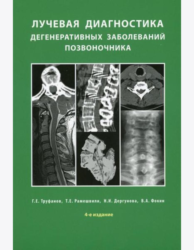 Лучевая диагностика дегенеративных заболеваний позвоночника
