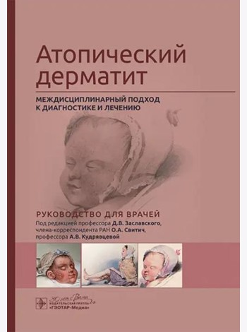 Атопический дерматит. Междисциплинарный подход к диагностике и лечению. Руководство для врачей