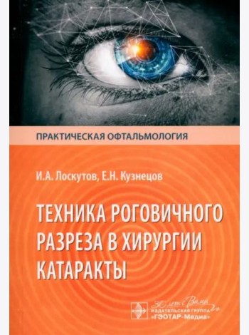 Техника роговичного разреза в хирургии катаракты