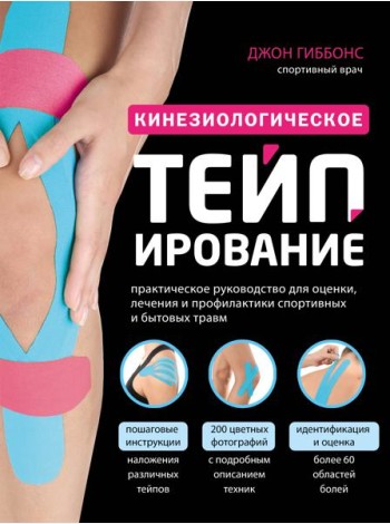 Кинезиологическое тейпирование